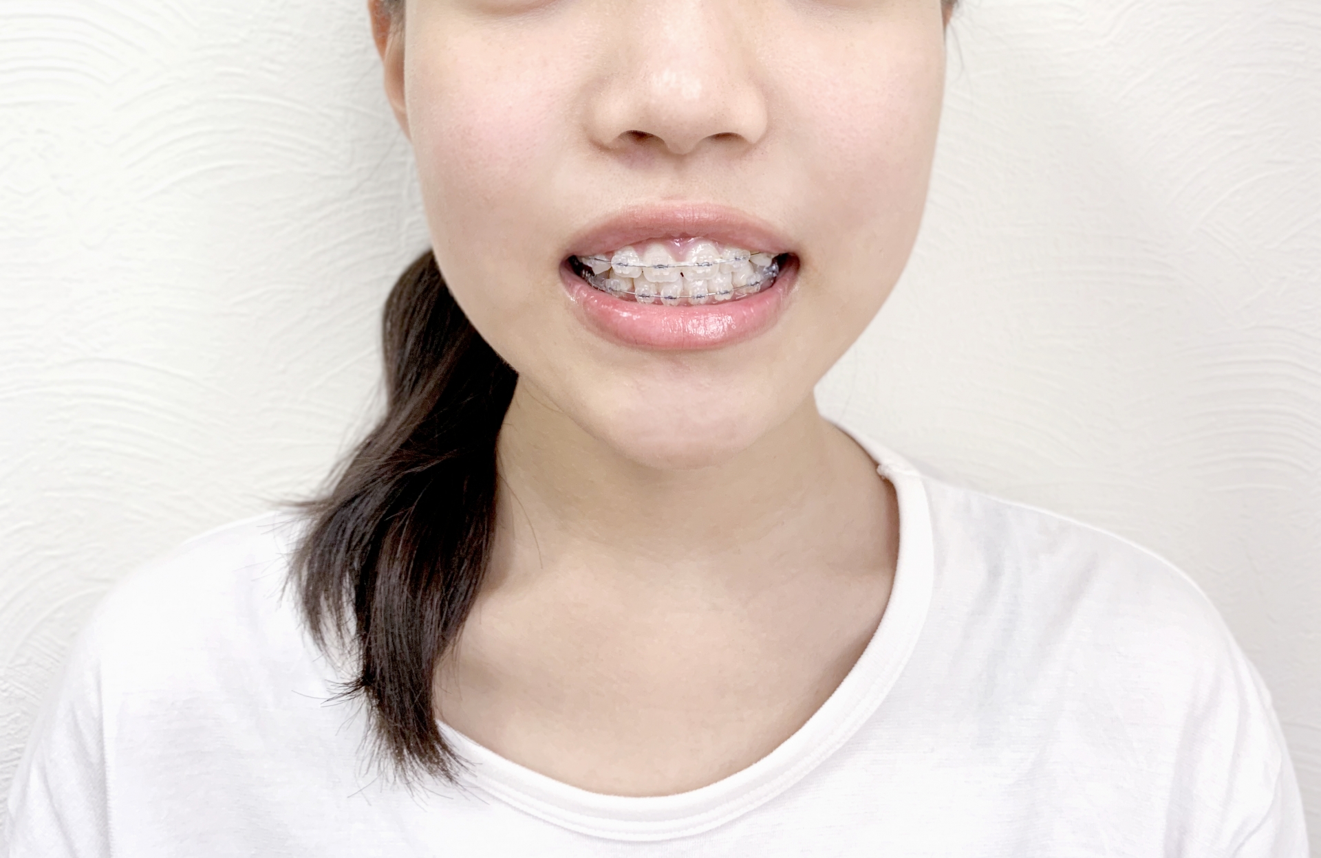 お子様の矯正を検討していただきたい歯並び