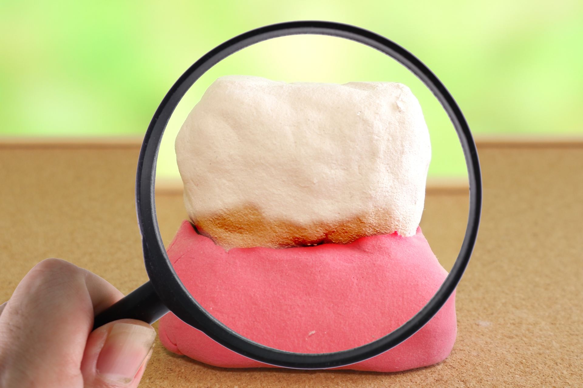 重度歯周病で失われた骨を取り戻す「歯周組織再生療法」とは？